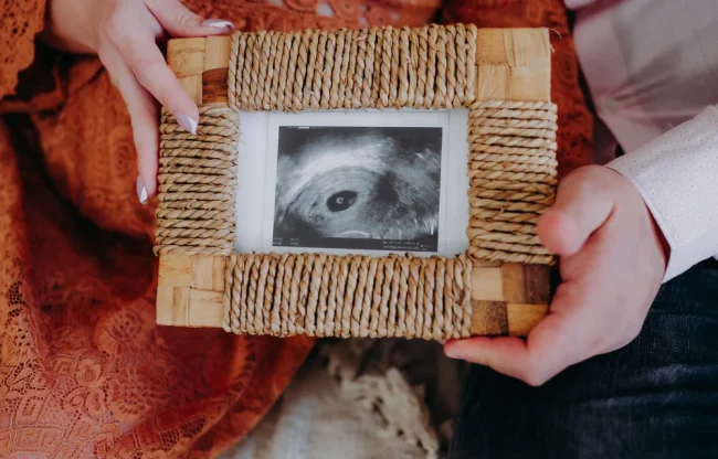 Sesja-Ciążowa-Szczecin-9